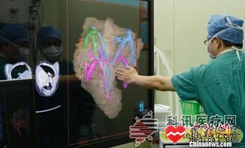 中国首例应用计算机三维手术决策系统分离联体男婴