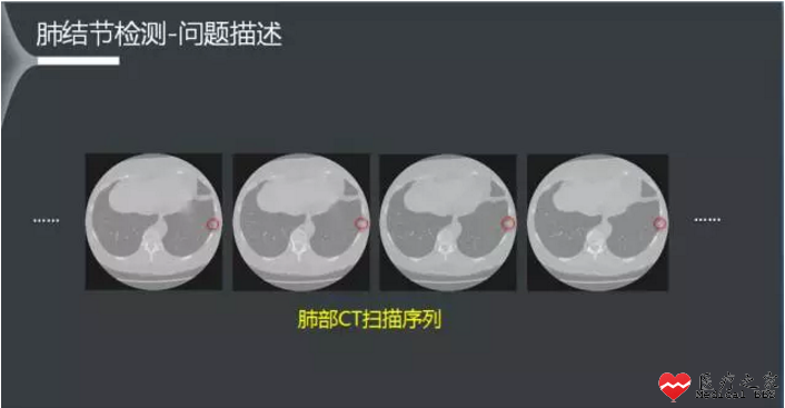 a41f7295e5de1abee1b81c.png
