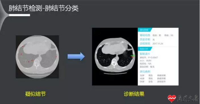 a41f7295e5de1abee23b23.png