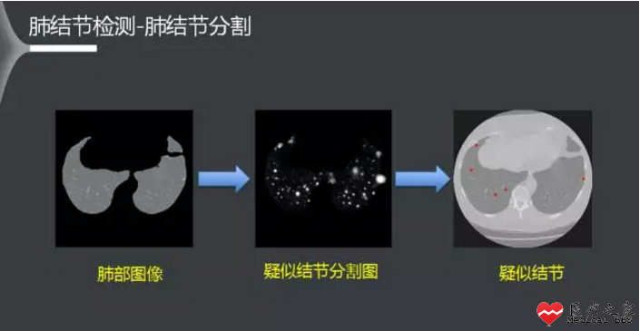 a41f7295e5de1abee21821.png