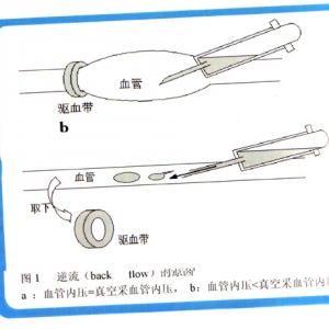 真空采血管，可能引起的危险与解决措施