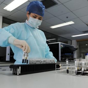 女性性激素6项的常识及临床意义