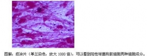 了解病原体，“看明白”肺炎