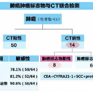 肺癌标志物+CT联合检测 降低肺癌漏检率