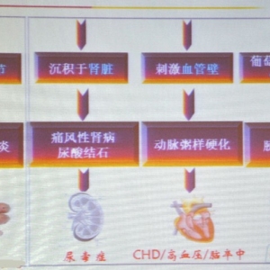 [CSA&TISC2015]章成国：高尿酸血症 值得关注的第4高