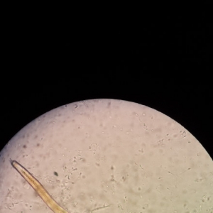罕见！精液镜检发现了寄生虫