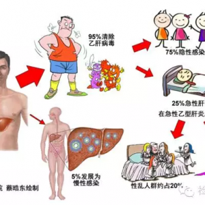 详解乙型肝炎的性传播