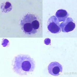 从细胞蛋白分离现象发现破绽