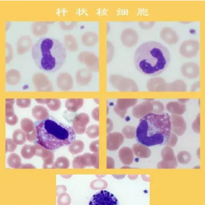 张时民：美丽的杆状核细胞