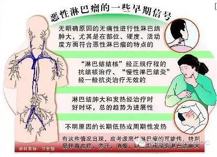 哪类人易患淋巴瘤 ?