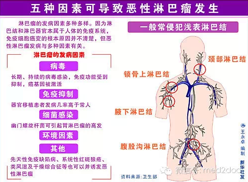 哪类人易患淋巴瘤 ?