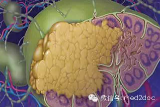 哪类人易患淋巴瘤 ?