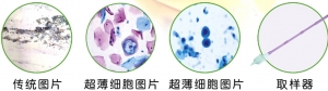 巴氏涂片检查 VS HPV检测