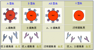 骨髓移植是否会导致血型改变