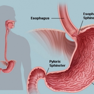 Gastroenterology：新研究或可助力解决胃癌诊断治疗难题