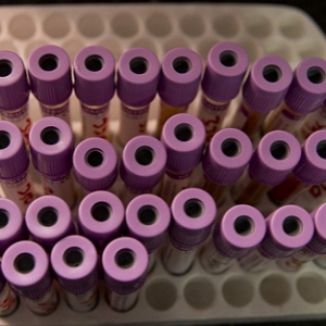 FDA：要延迟发布LDTs指南草案咯！