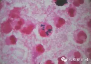 细菌检验对临床的重要性