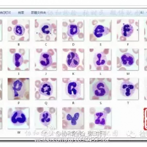 张时民：唯美的二十六个英文字母的细胞核型图