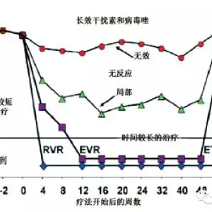 HCV感染诊断和管理中的检测问题之病例3