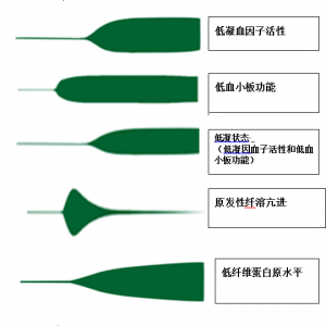 教你一秒看懂TEG，凝血功能早知道