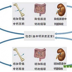 恶性肿瘤相关的高钙血症