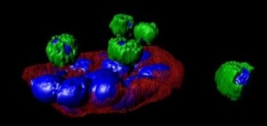 美科学家为癌细胞染色 可迅速确定扩散方式路径