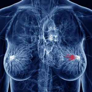 Cell Stem Cell：人类乳腺癌细胞与乳腺干细胞具有相似性