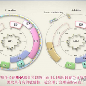 【让宫颈癌远离女性】人乳头瘤病毒(HPV)与宫颈癌