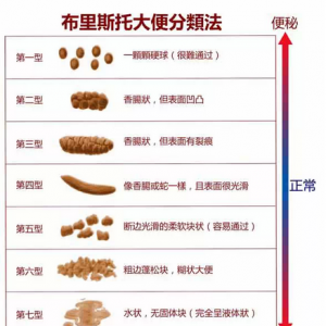 通过大小便进行健康自检：请回头看它们最后一眼