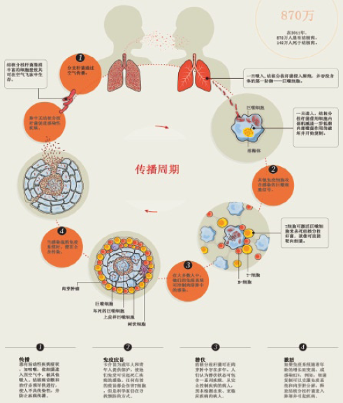 对抗结核病的100年 ——全球视角