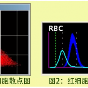 血常规检查可以初步筛检缺铁性贫血吗？