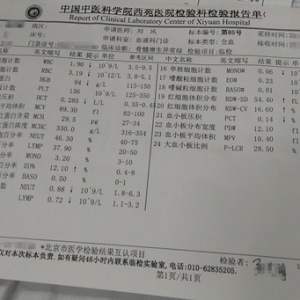 小小血常规，告诉你很多事儿