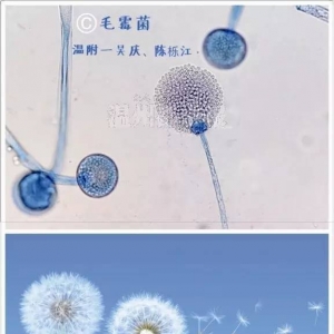 附一院检验科医生所拍的显微镜下真菌美图引起热议