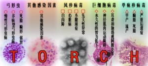 优生优育之Torch筛查