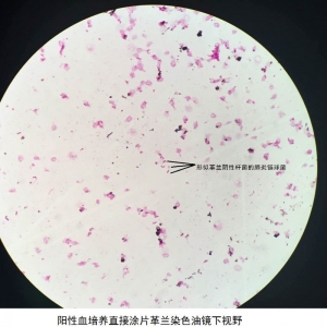 【检验临床面对面】“变脸高手”——阳性血培养中的肺炎链球菌 ... ...