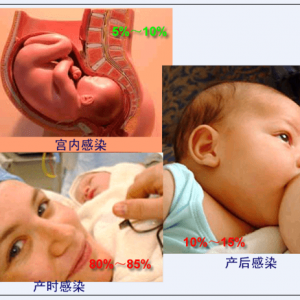 我的孩子是怎样感染的乙肝病毒？