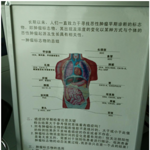 谈“癌”色变，您的肿瘤标志物高吗？