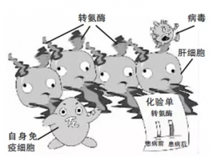 切勿被“转氨酶”蒙蔽双眼
