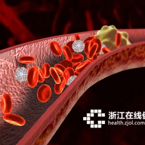 血管、血脂检查都没问题，为什么还会得静脉血栓？