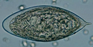 用基于生物传感器的快速尿检检测泌尿生殖道血吸虫病