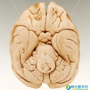 研究显示，脑脊液可以作为脑癌检测的潜在液体样本活检来源 ... ...