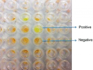 用新颖的分子工具检测无症状的疟疾感染者