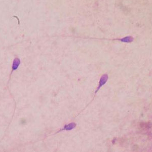 科学家利用皮肤细胞生成人类精子