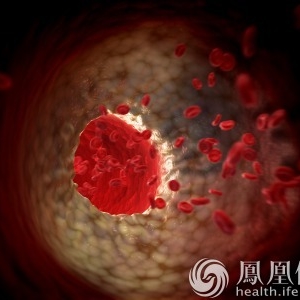 每天喝它活血化瘀护心脏 降压降脂降三高！