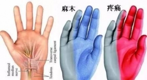手脚麻木竟是6大疾病先兆！？