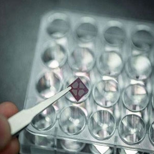 检测心脏病疾患的新方法
