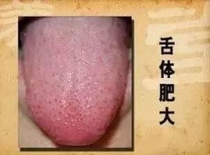 祛湿气最厉害的，不是薏米，而是它！这样吃把湿气一扫而光 ... ...