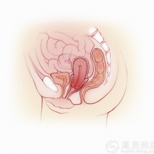 学会三招清理肠道垃圾