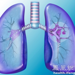 这些是癌症留下的蛛丝马迹