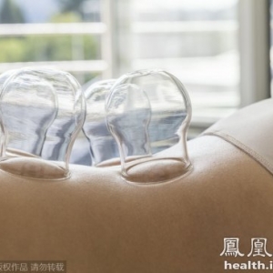 拔火罐岂是愚昧权？拔罐符合中医的经络原理